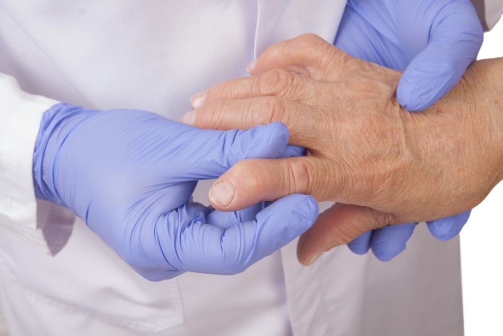 Reumatología - artritis en mujer mayor